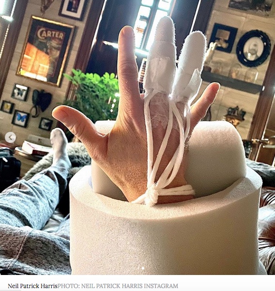 Neil Patrick Harris swelling